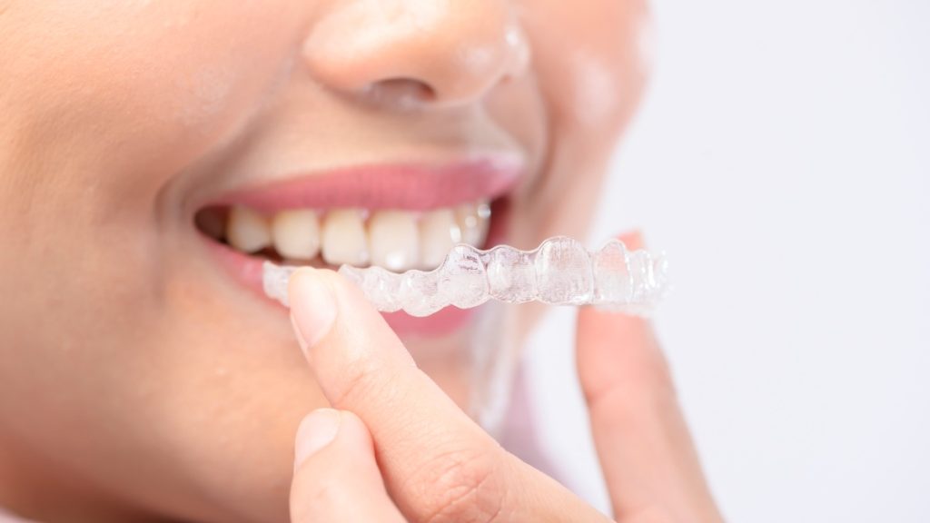 Young smiling woman holding invisalign braces over white background studio, dental healthcare and Orthodontic concept