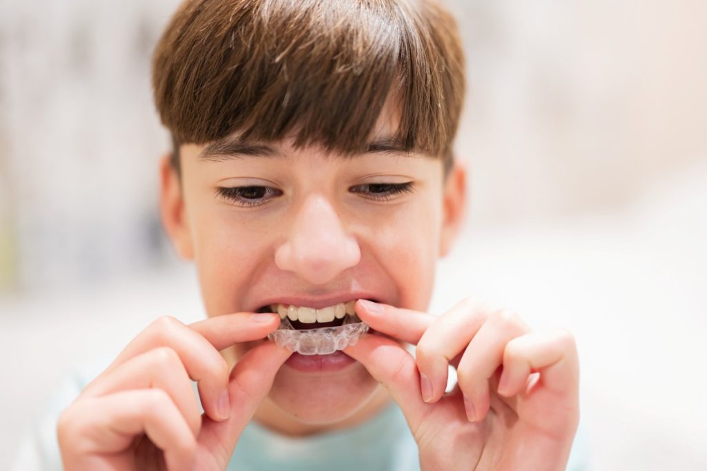 Teenager boy wear simulator orthodontic silicone invisible leveling braces for teeth