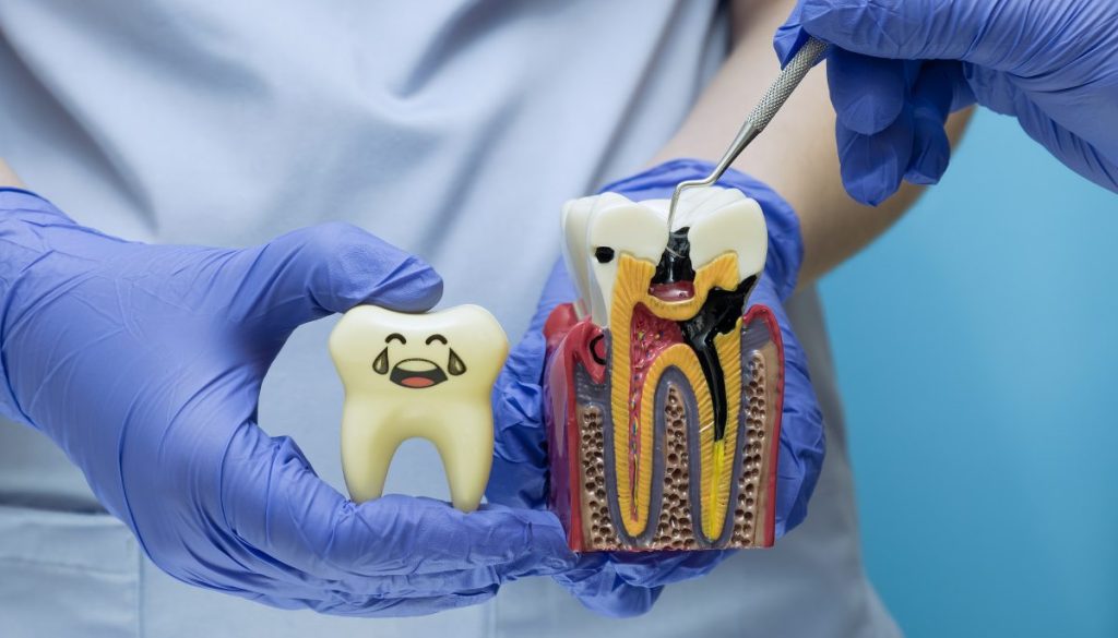 Dentist in gloves using a probe on a decayed tooth model next to a happy healthy tooth toy